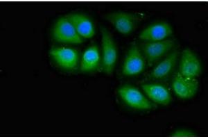 Immunofluorescent analysis of A549 cells using ABIN7159160 at dilution of 1:100 and Alexa Fluor 488-congugated AffiniPure Goat Anti-Rabbit IgG(H+L) (MED4 抗体  (AA 167-270))