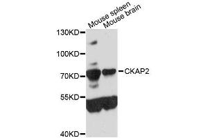 Western blot analysis of extracts of various cell lines, using CKAP2 antibody (ABIN5996642) at 1:3000 dilution. (CKAP2 抗体)
