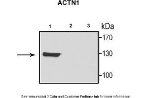 Sample Type: 1. (ACTN1 抗体  (N-Term))