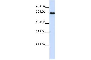 Leiomodin 1 antibody used at 1 ug/ml to detect target protein. (Leiomodin 1 抗体)