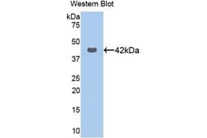 Western blot analysis of the recombinant protein. (KRT16 抗体  (AA 117-419))