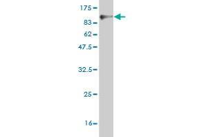 Western Blot detection against Immunogen (85. (UBP1 抗体  (AA 1-540))