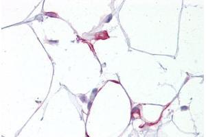 Anti-CXXC4 antibody IHC staining of human adipocytes. (CXXC4 抗体  (N-Term))