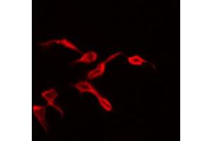 ABIN6269398 staining 293 by IF/ICC. (WNK1 抗体  (N-Term))