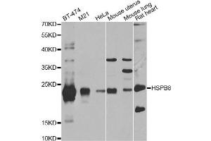 Western blot analysis of extracts of various cell lines, using HSPB8 antibody (ABIN5971347) at 1/1000 dilution. (HSPB8 抗体)