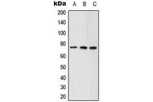 Western blot analysis of ABCD1 expression in HeLa (A), mouse brain (B), rat kidney (C) whole cell lysates.