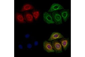 ABIN6257891 and ABIN6273815 staining Hela cells by IF/ICC. (TRIO 抗体  (Internal Region))
