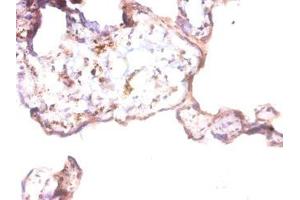 Immunohistochemistry of paraffin-embedded human placenta tissue using ABIN7144088 at dilution of 1:50 (Angiopoietin 1 抗体  (AA 16-498))