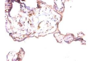Immunohistochemistry of paraffin-embedded human placenta tissue using ABIN7144088 at dilution of 1:50 (Angiopoietin 1 抗体  (AA 16-498))
