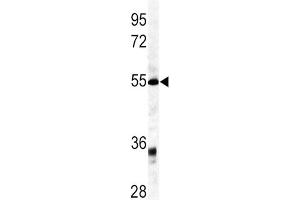 Western Blotting (WB) image for anti-Growth Differentiation Factor 6 (GDF6) antibody (ABIN3003243) (GDF6 抗体)