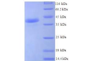 SDS-PAGE (SDS) image for Josephin Domain Containing 1 (JOSD1) (AA 1-202), (full length) protein (His-SUMO Tag) (ABIN5711339)
