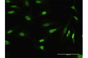 Immunofluorescence (IF) image for anti-Mismatch Repair Protein 2 (MSH2) (AA 1-934) antibody (ABIN518021)