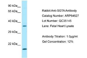Western Blotting (WB) image for anti-Small Glutamine-Rich Tetratricopeptide Repeat (TPR)-Containing, alpha (SGTA) (C-Term) antibody (ABIN2789863) (SGTA 抗体  (C-Term))