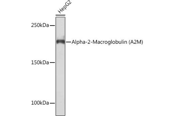 alpha 2 Macroglobulin anticorps