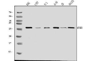 Western blot analysis of GTF2F2 using anti-GTF2F2 antibody (ABIN7599927).