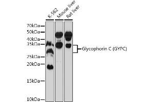 Western blot analysis of extracts of various cell lines, using Glycophorin C (GYPC) (GYPC) Rabbit mAb (ABIN7267476) at 1:1000 dilution. (CD236/GYPC 抗体)