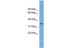 WB Suggested Anti-C3orf49 Antibody Titration: 0. (C3orf49 抗体  (Middle Region))