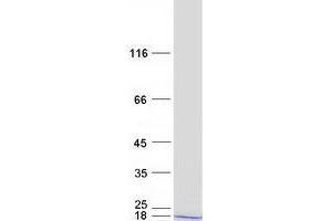 Western Blotting (WB) image for Ribosomal Protein L24 (RPL24) protein (Myc-DYKDDDDK Tag) (ABIN2731133)