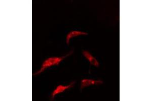ABIN6274864 staining HeLa cells by IF/ICC. (ARMC6 抗体  (C-Term))