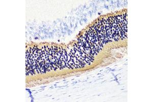Immunohistochemistry of paraffin-embedded rat retina using PDC antibody (ABIN6132871, ABIN6145332, ABIN6145333 and ABIN6224509) at dilution of 1:200 (40x lens). (Phosducin 抗体  (AA 1-246))