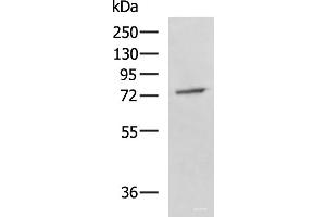 Western blot analysis of A549 cell lysate using GPCPD1 Polyclonal Antibody at dilution of 1:800 (GPCPD1 抗体)