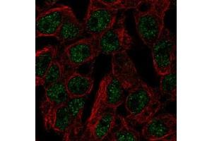 Immunofluorescent staining of HepG2 with SLC5A11 polyclonal antibody  (Green) shows localization to nucleoplasm. (Solute Carrier Family 5 (Sodium/inositol Cotransporter), Member 11 (SLC5A11) 抗体)