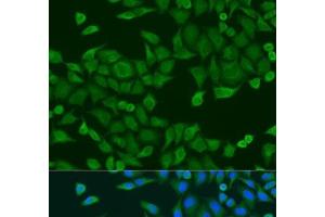 Immunofluorescence analysis of U2OS cells using RPS27A Polyclonal Antibody at dilution of 1:100. (RPS27A 抗体)