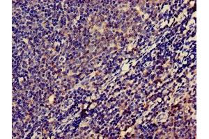 Immunohistochemistry of paraffin-embedded human lymph node tissue using ABIN7158308 at dilution of 1:100 (Leupaxin 抗体  (AA 1-300))
