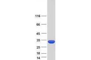 Validation with Western Blot