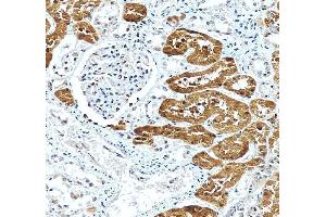 anti-Glycerol Kinase (GK) (AA 1-180) antibody