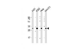 All lanes : Anti-CDK5 Antibody at 1:2000 dilution Lane 1: A431 whole cell lysate Lane 2: K562 whole cell lysate Lane 3: Hela whole cell lysate Lane 4: NIH/3T3 whole cell lysate Lysates/proteins at 20 μg per lane. (CDK5 抗体)