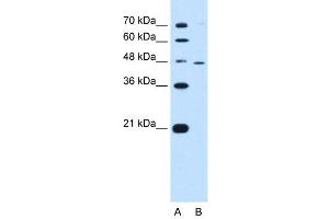 RNF25 antibody used at 0. (RNF25 抗体  (Middle Region))