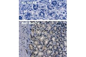 Immunohistochemistry (IHC) image for anti-RAB1A, Member RAS Oncogene Family (RAB1A) (C-Term) antibody (ABIN7272978) (RAB1A 抗体  (C-Term))