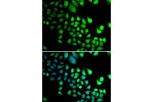 Immunofluorescence analysis of A-549 cells using RBBP5 antibody.