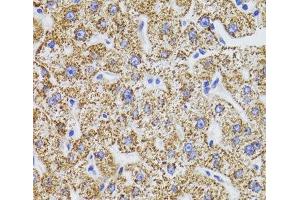 Immunohistochemistry of paraffin-embedded Human liver using GATM Polyclonal Antibody at dilution of 1:100 (40x lens). (GATM 抗体)