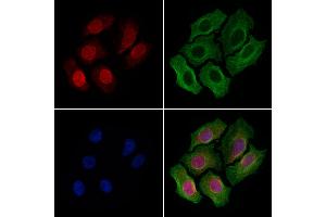 ABIN6263773 and ABIN6279619 staining Hela cells by IF/ICC.