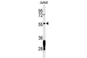 Western blot analysis of RNF8 Antibody in Jurkat cell line lysates (35µg/lane).