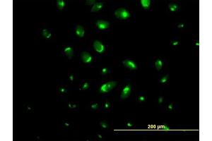 Immunofluorescence (IF) image for anti-ATPase, Ca++ Transporting, Type 2C, Member 1 (ATP2C1) (AA 1-919) antibody (ABIN525805)