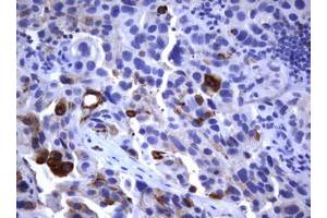 Image no. 1 for anti-Fc Fragment of IgE, Low Affinity II, Receptor For (CD23) (FCER2) (AA 48-321) antibody (ABIN1491554)