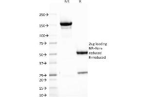 SDS-PAGE (SDS) image for anti-V-Set Domain Containing T Cell Activation Inhibitor 1 (VTCN1) antibody (ABIN6940936)