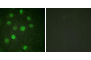 serum + -Immunofluorescence analysis of HuvEc cells, treated with serum (20%, 15mins), using Histone H1 (Ab-17) antibody. (Histone H1 抗体)