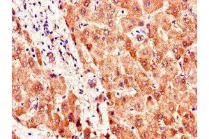 Immunohistochemistry of paraffin-embedded human liver tissue using ABIN7169898 at dilution of 1:100 (SMO 抗体  (AA 28-233))