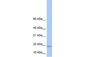 LOC284009 antibody used at 1 ug/ml to detect target protein. (LOC284009 抗体  (N-Term))