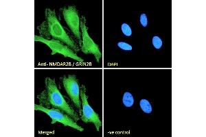 (ABIN185658) Immunofluorescence analysis of paraformaldehyde fixed HeLa cells, permeabilized with 0. (GRIN2B 抗体  (Internal Region))