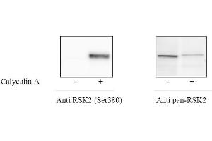 HeLa cells were treated or untreated with Calyculin A. (ATF2 ELISA 试剂盒)