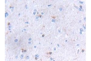 Detection of GLTP in Human Cerebrum Tissue using Polyclonal Antibody to Glycolipid Transfer Protein (GLTP) (GLTP 抗体  (AA 2-209))