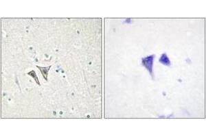 Immunohistochemistry (IHC) image for anti-Activin Receptor Type 1C (ACVR1C) (AA 201-250) antibody (ABIN1534006)
