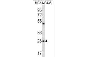 CDRT15L2 Antibody (C-term) (ABIN656444 and ABIN2845729) western blot analysis in MDA-M cell line lysates (35 μg/lane). (CDRT15L2 抗体  (C-Term))