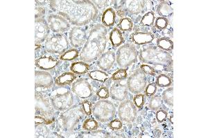 Immunohistochemistry of paraffin-embedded rat kidney using DC Rabbit mAb (ABIN7266685) at dilution of 1:200 (40x lens). (DCAF7 抗体)