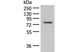 Western blot analysis of Hela cell lysate using TRMT1 Polyclonal Antibody at dilution of 1:300 (TRMT1 抗体)